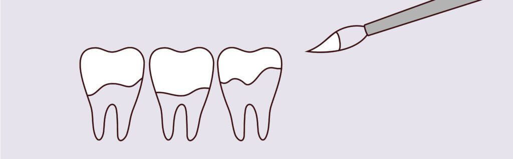 Dreamscape Imagery 01 1024x318 1 Intrinsic Family Dental