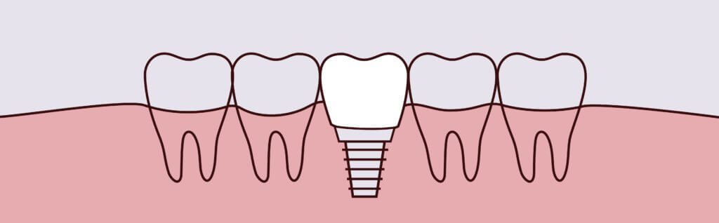 Dreamscape Imagery 05 1024x318 Intrinsic Family Dental