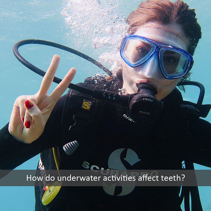 underwater teeth 2022 700 Intrinsic Family Dental