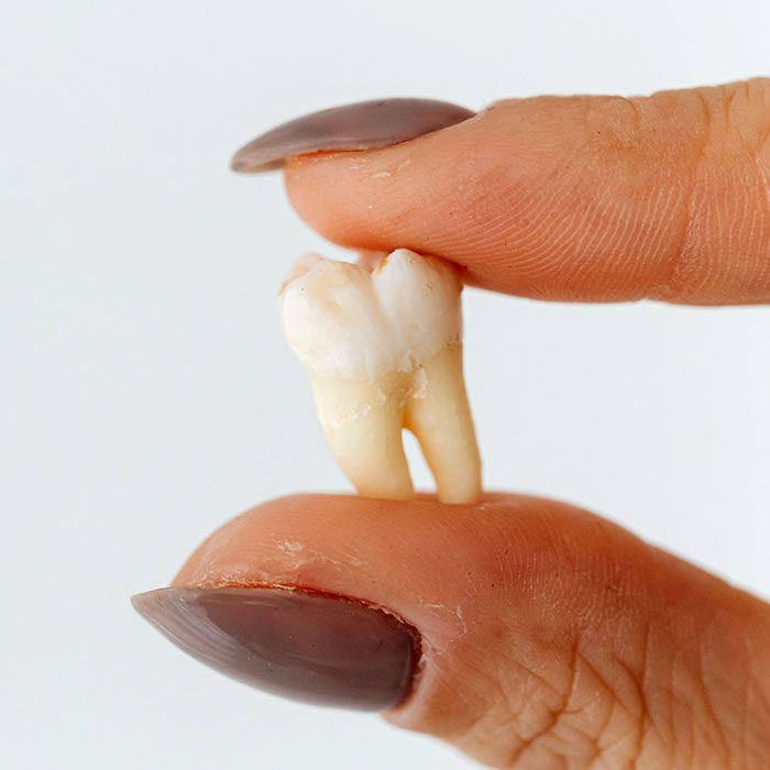 baby teeth traditions 2023 700 Intrinsic Family Dental